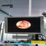 LINVATEC HD 4300 Arthroscope for repair - Image 5