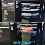 Philips L12-3 Ultrasuound probe for repair - Image 5