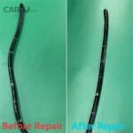 OLYMPUS TJF-Q180V DUODENOSCOPE FOR REPAIR - Image 4