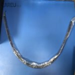 Insertion Tube For Olympus GIF-XTQ160 gastrointestinal videoscope